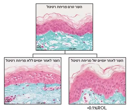 רטינול