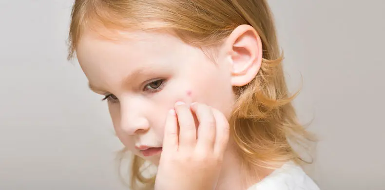 תופעות העור השכיחות ביותר בקרב תינוקות וילדים
